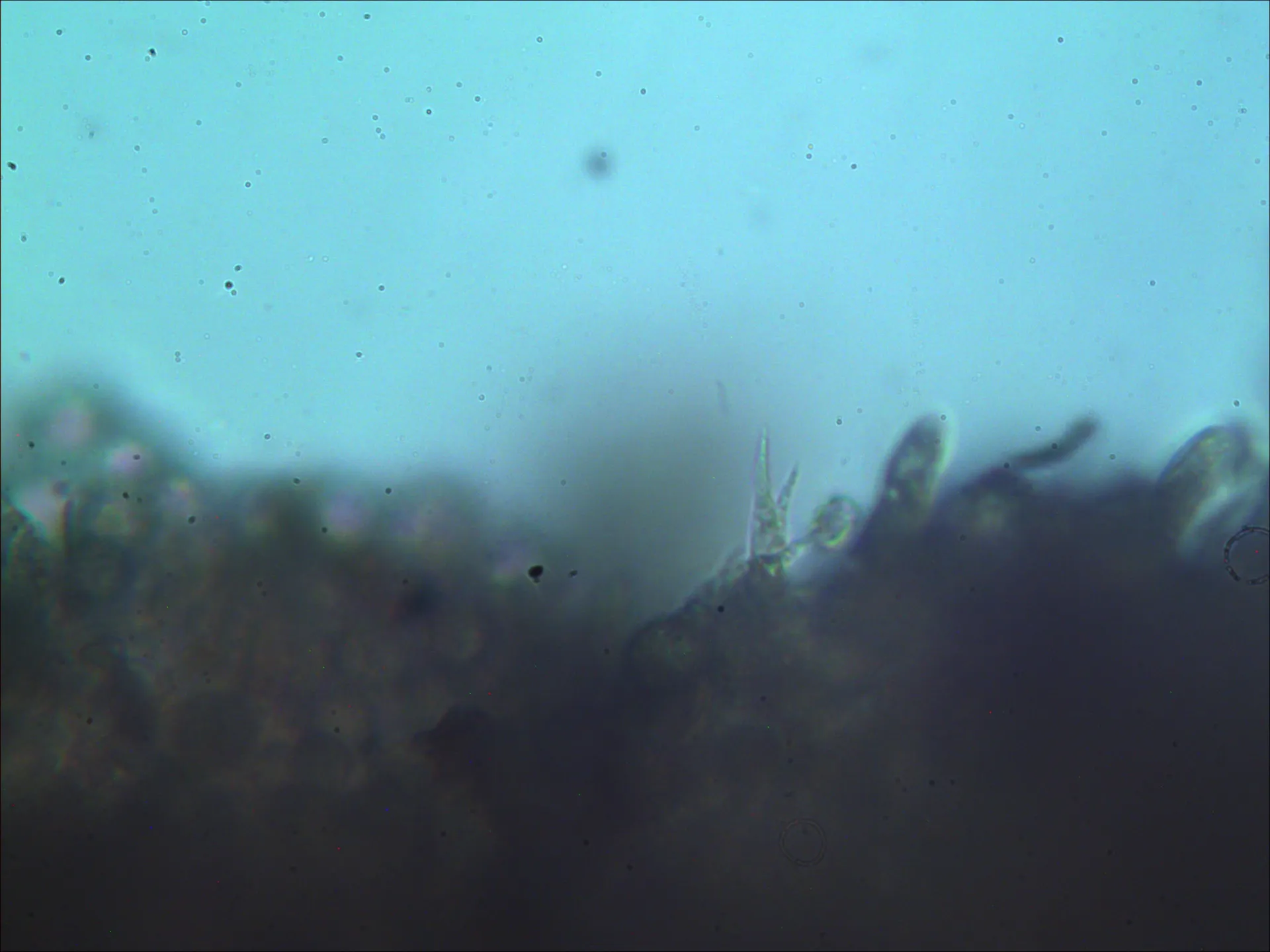 Microscopía de Hydnangium carneum - basidio bisporico